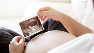pregnant stomach holding scan picture